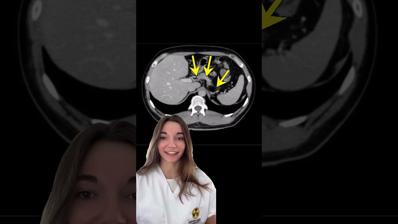 QUIZ ANATOMIE FACILE - SCANNER TAP